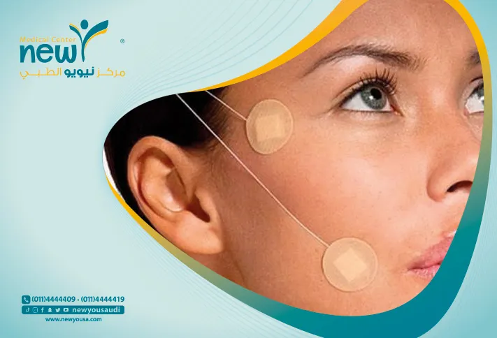 افضل مركز و دكتور لشد الوجه بالخيوط الذهبية بالرياض -عيادات نيويو