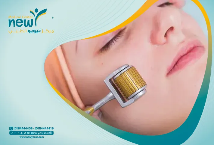 الديرما رولر للصلع الوراثي تعرف عليه من خلال مركزنا الطبي في السعودية | نيويو