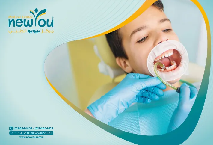 مشاكل الأسنان الشائعة