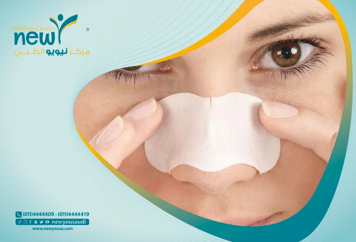 عملية تجميل الأنف للمراهقين كل ما تريد معرفته عنها من خلال مركزنا الطبي في السعودية | نيويو