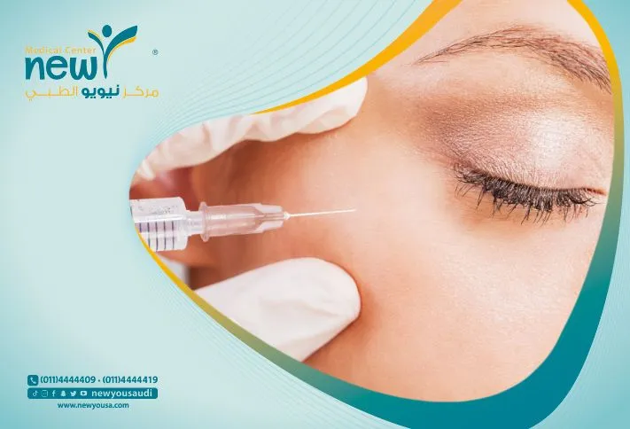 علاج انتفاخ العين بعد البوتكس