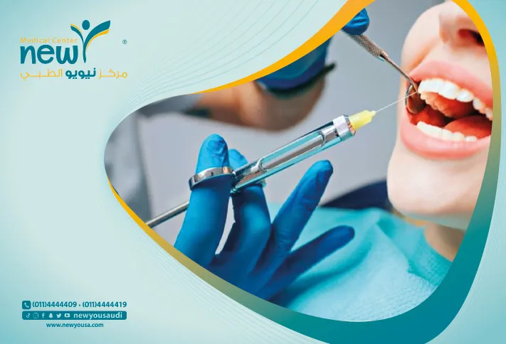 أنواع بنج الأسنان