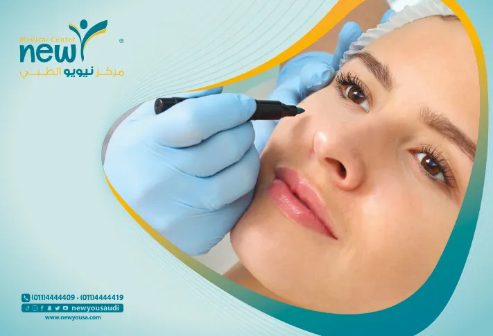 بعد عملية تجميل الأنف كل ما تريد معرفته عنها من خلال مركزنا الطبي في السعودية | نيويو