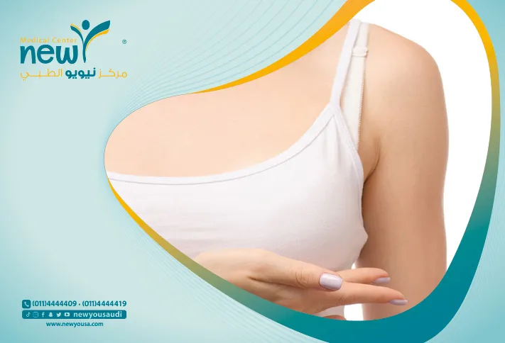 عملية شد الصدر كل ما تريدي معرفته عنها من خلال مركزنا الطبي في السعودية | نيويو