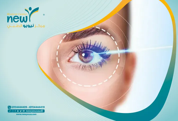 جراحة العيون بالليزر كل ما تريد معرفته عنها من خلال مركزنا الطبي في السعودية | نيويو