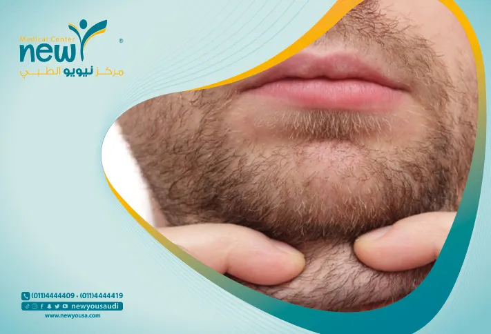 الذقن المزدوجة كل ما تريدي معرفته عنها من خلال مركزنا الطبي في السعودية | نيويو