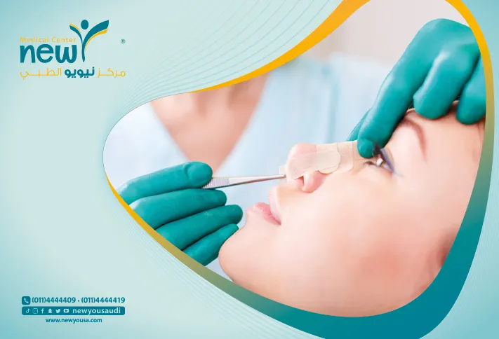 تجميل الأنف بدون جراحة كل ما تريد معرفته عنه من خلال مركزنا الطبي في السعودية | نيويو