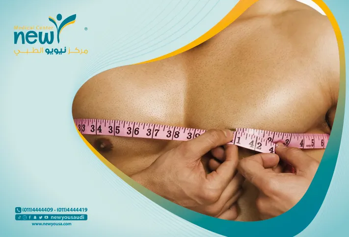 جراحة ازالة التثدي كل ما تريد معرفته عنها من خلال مركزنا الطبي في السعودية | نيويو