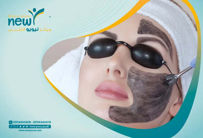 الليزر الكربوني تعرف عليه من خلال مركزنا الطبي في السعودية | نيويو