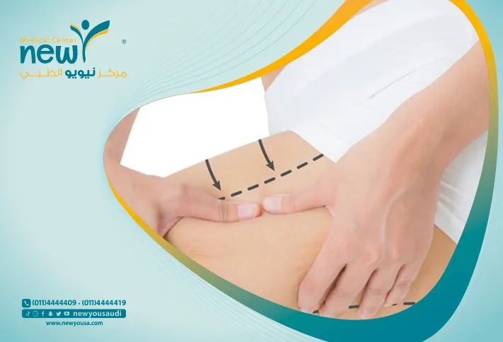 تقنية BBL لتجميل الارداف