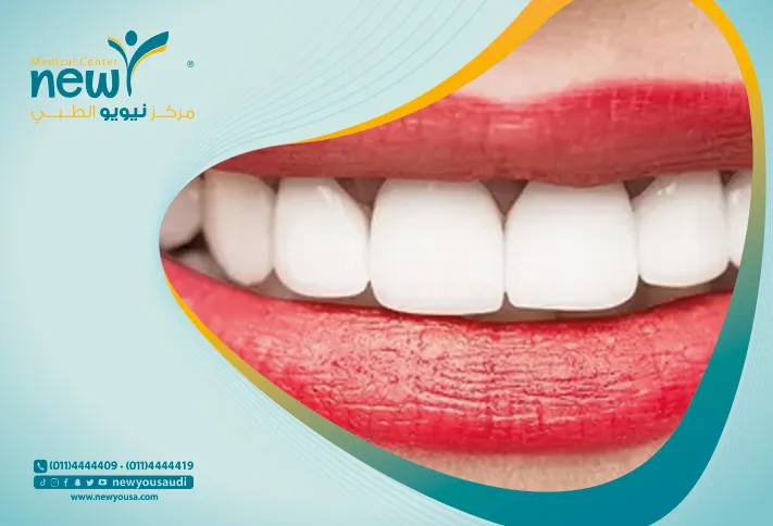 كيف يتم علاج تعري جذور الأسنان