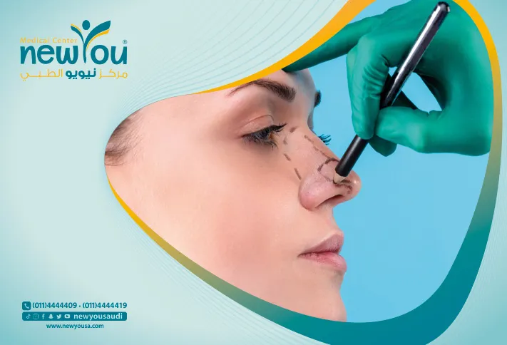عملية تجميل الأنف كل ما تريد معرفته عنها و اكثر من خلال مركزنا الطبي في السعودية | نيويو