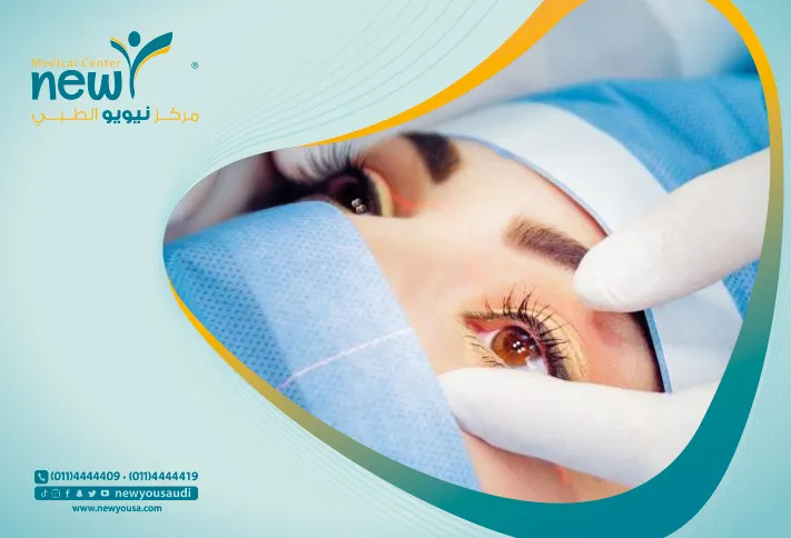 عملية توسيع العين هل هي ممكنة؟