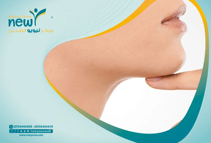 الذقن المزدوجة  كل ما تريد معرفتها عنها من خلال مركزنا الطبي في السعودية | نيويو