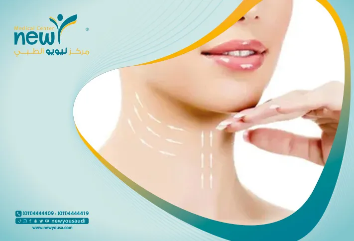 عملية شد الرقبة كل ما تريدي معرفته عنها من خلال مركزنا الطبي في السعودية | نيويو