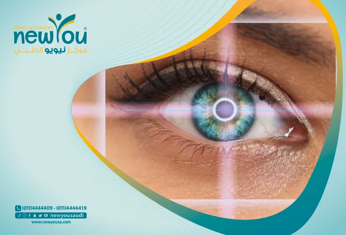 عملية تثبيت القرنية كل ما تريد معرفته عنها من خلال مركزنا الطبي في السعودية | نيويو