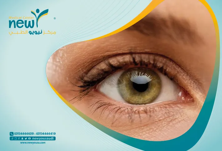 بياض في سواد العين أسباب وعلاجات
