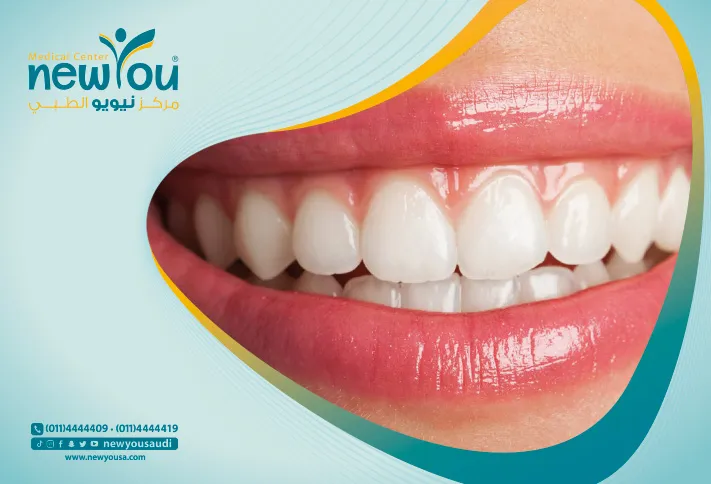 قص اللثة تعرف عليه من خلال مركزنا الطبي في السعودية | نيويو