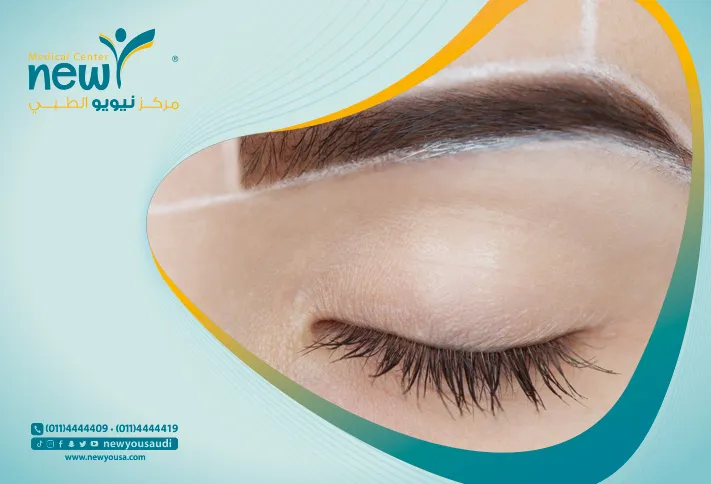 عملية شد الجبهة ورفع الحواجب تعرف عليها من خلال مركزنا الطبي في السعودية | نيويو
