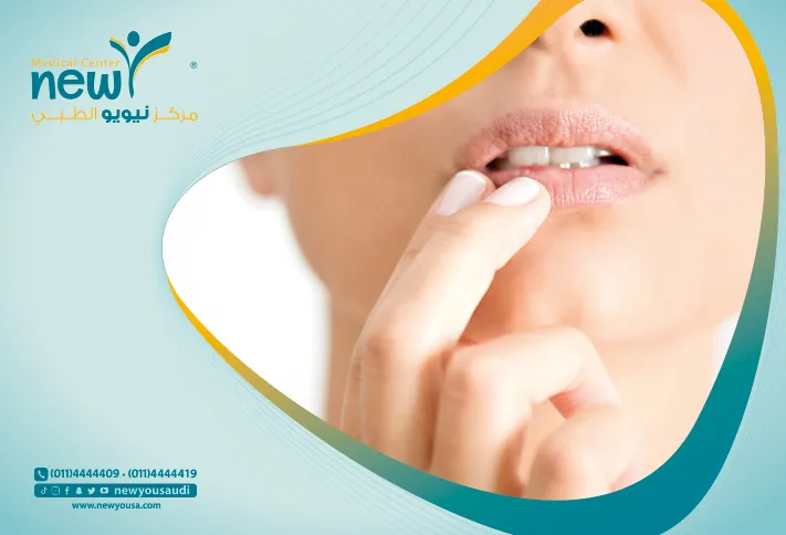 الأدويه العلاجيه و تأثيرها على الفم