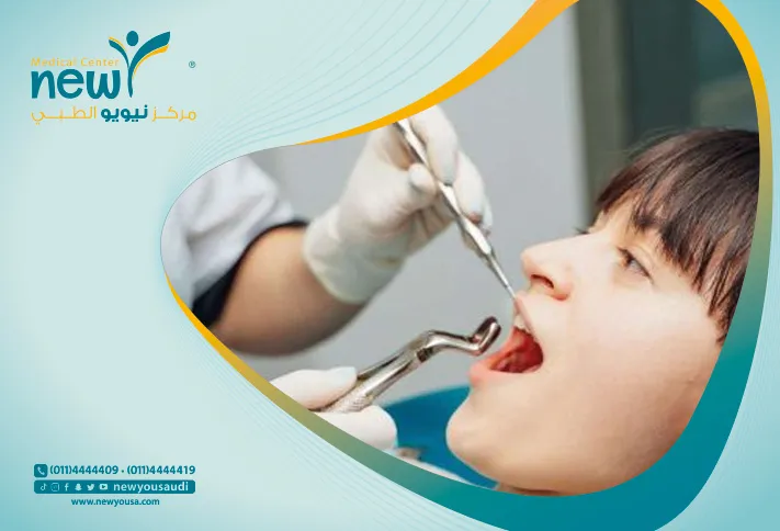 ضرس العقل كل ما تريد معرفته عنها من خلال مركزنا الطبي في السعودية | نيويو