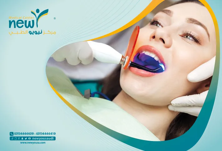 تبييض الاسنان بالليزر تعرف عليه من خلال مركزنا الطبي في السعودية | نيويو