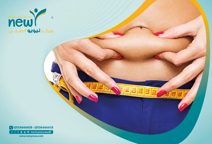 جراحات السمنة لانقاص الوزن والحصول علي جسم مثالي في السعودية | نيويو