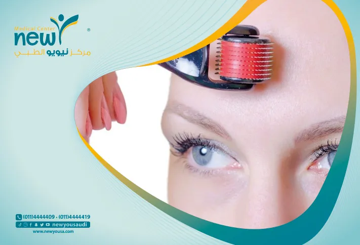 الديرما رولر كل ما تريدي معرفته عنها من خلال مركزنا الطبي في السعودية | نيويو