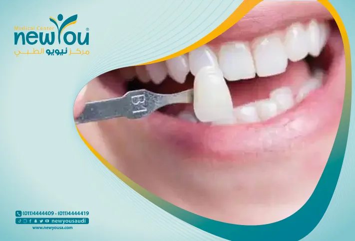 عملية زراعة الاسنان تعرف عليها من خلال مركزنا الطبي في السعودية | نيويو