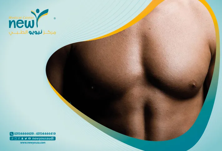 التثدي كل ما تريد معرفته عنه من خلال مركزنا الطبي في السعودية | نيويو