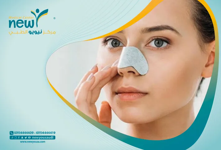 ازاله الرؤوس السوداء تعرف عليه من خلال مركزنا الطبي في السعودية | نيويو