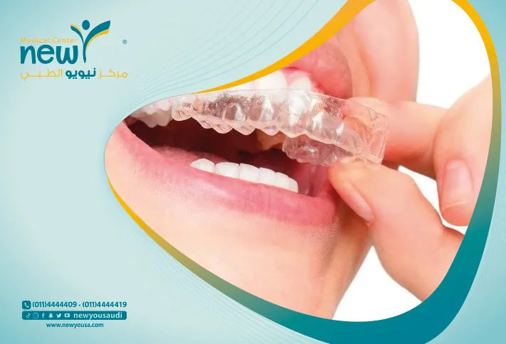 التقويم الشفاف تعرف عليه من خلال مركزنا الطبي في السعودية | نيويو