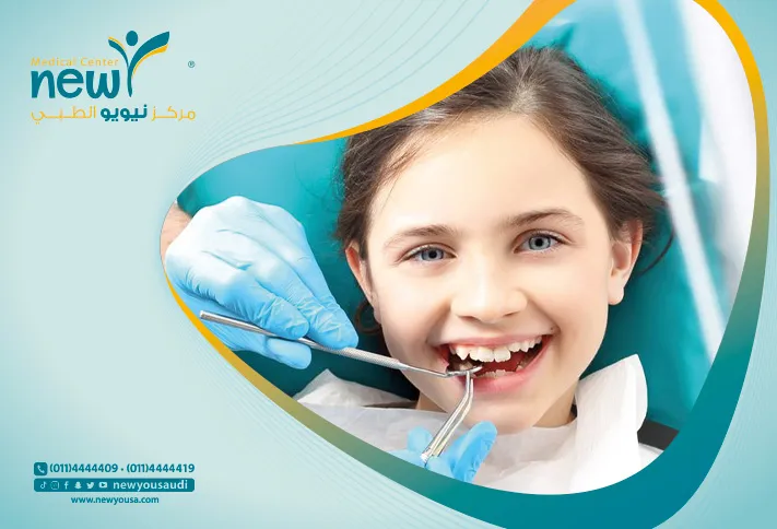 ماهو فلورايد الاسنان