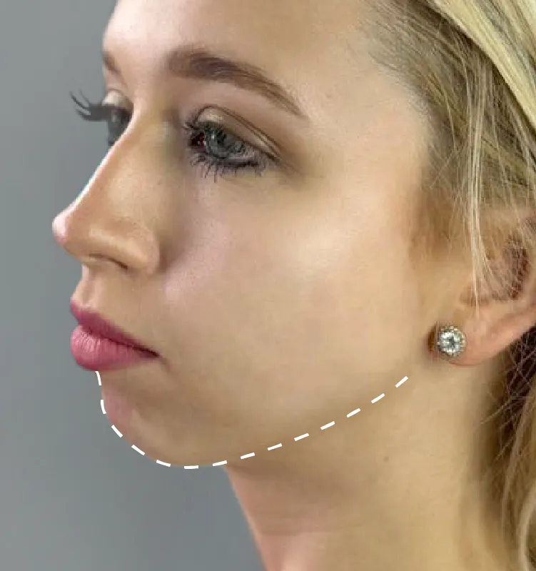 Before - الجلدية