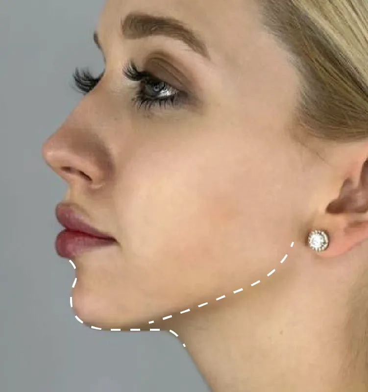 After - الجلدية