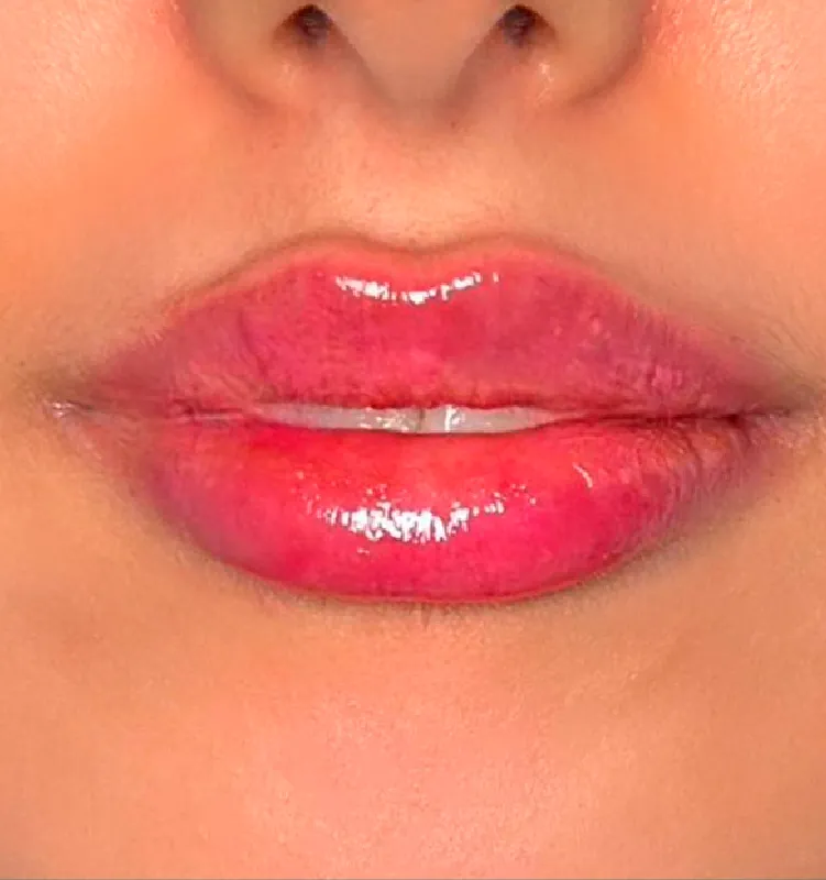 After - الجلدية