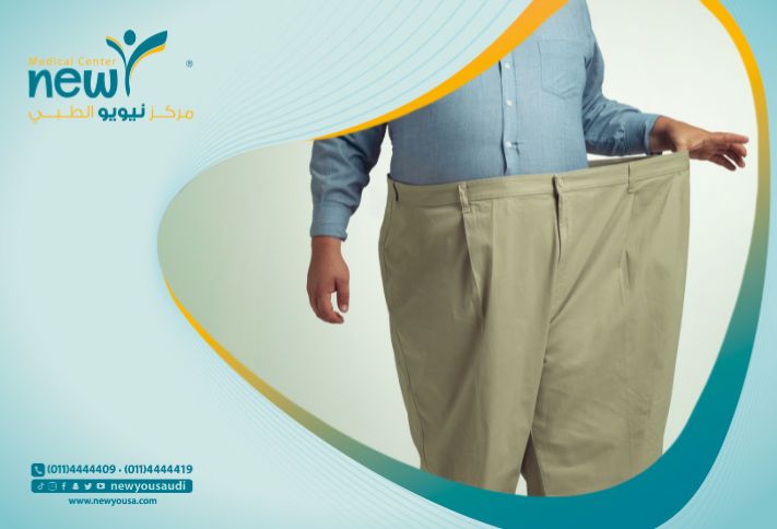 ماذا بعد عملية التكميم