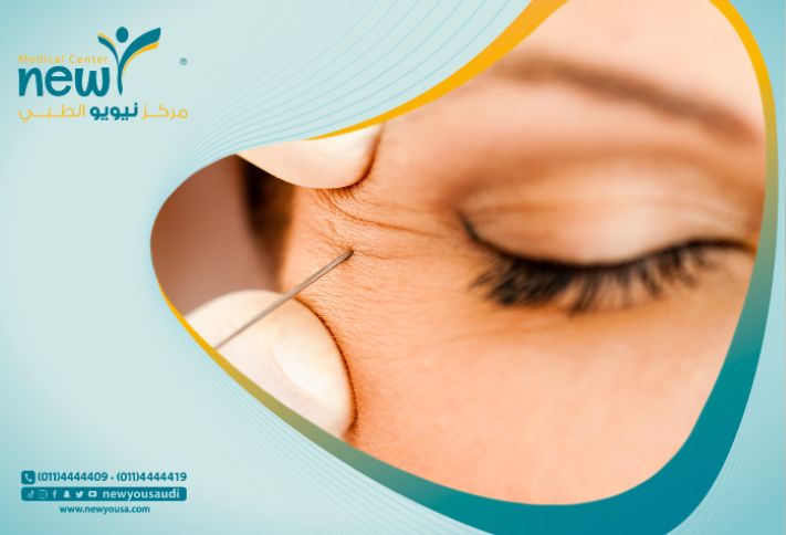 أفضل النتائج وتجنب الانتفاخ عند الحقن في مركز نيويو الطبي