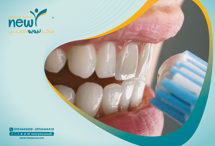 غسل الأسنان تعرف عليه من خلال مركزنا الطبي في السعودية | نيويو