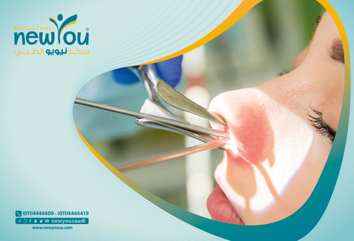 الاستحمام بعد عملية تجميل الأنف كل ما تريد معرفته عنه من خلال مركزنا الطبي في السعودية | نيويو