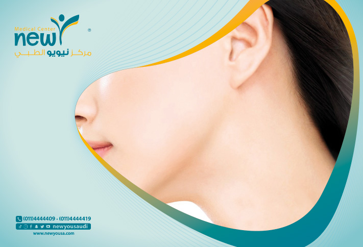 سواد الرقبة الأسباب وطرق العلاج