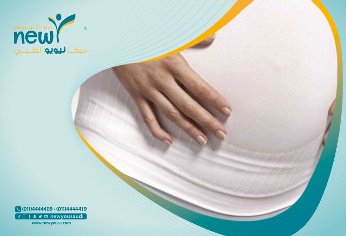 علاج كرمشة البطن بعد الولادة: طرق فعالة لاستعادة شد الجلد