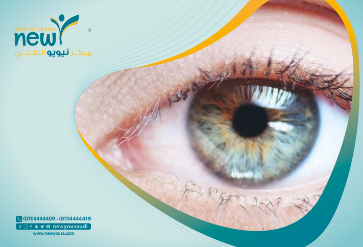 عيون الراكون تعرف عليه من خلال مركزنا الطبي في السعودية | نيويو
