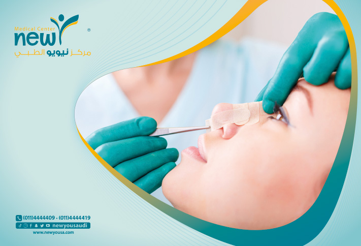 عملية تجميل الأنف بالرياض كل ما تريد معرفته عنها من خلال مركزنا الطبي في السعودية | نيويو