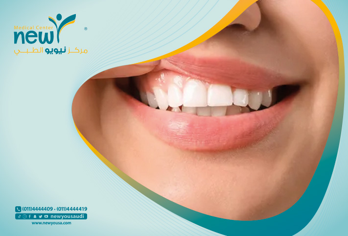 أسباب تصبغ اللثة كل ما تريد معرفته عنها من خلال مركزنا الطبي في السعودية | نيويو