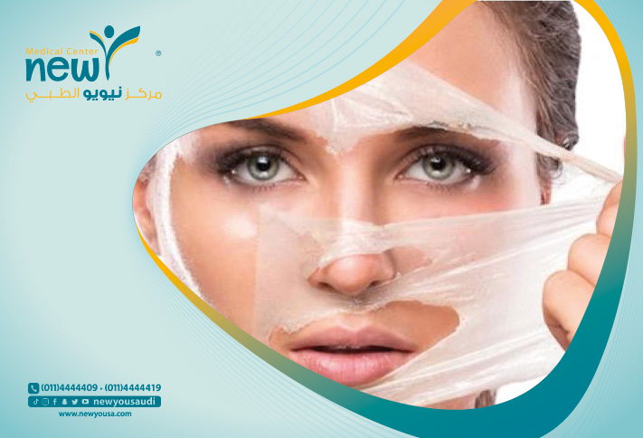 طرق تقشير البشرة تعرف عليه من خلال مركزنا الطبي في السعودية | نيويو