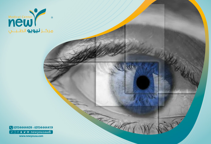 زراعة القرنية كل ما تريد معرفته عنها من خلال مركزنا الطبي في السعودية | نيويو
