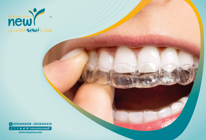 التقويم المتحرك كل ما تريد معرفته عنه و اكثر من خلال مركزنا الطبي في السعودية | نيويو