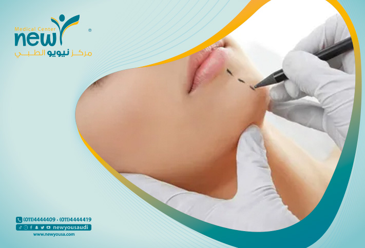 تجميل الوجة بالليزر كل ما تريد معرفته عنه من خلال مركزنا الطبي في السعودية | نيويو