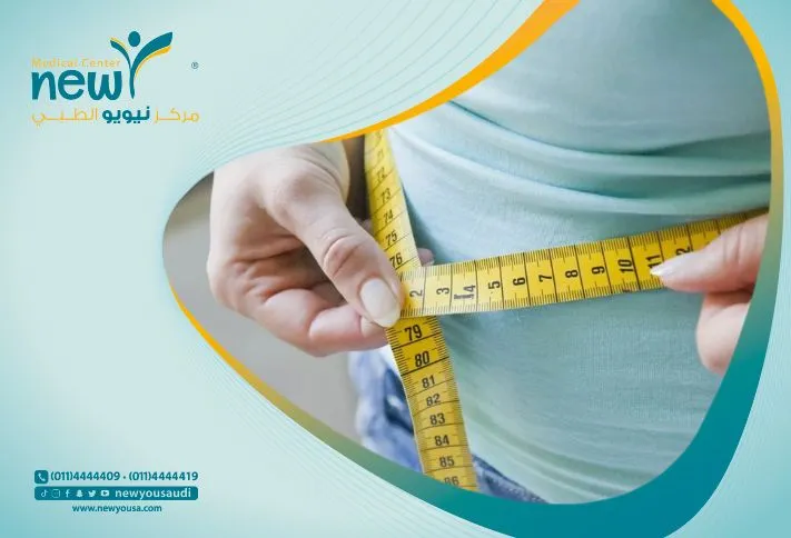 متى يزول خطر التسريب بعد التكميم؟ | مركز نيويو الطبي